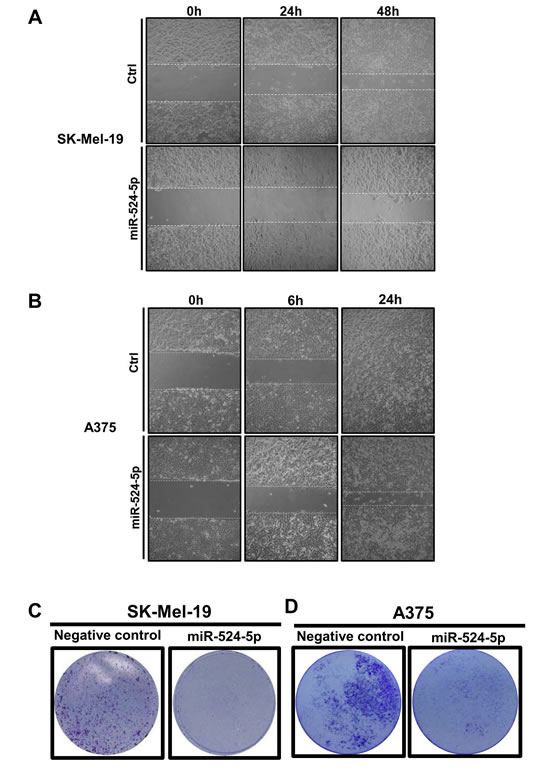 miR-524-5p reduces the migration of melanoma cells.