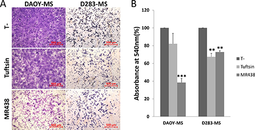 Effects of MR438 or Tuftsin on invasive ability of MB stem cells derived from DAOY and D283 cell lines.