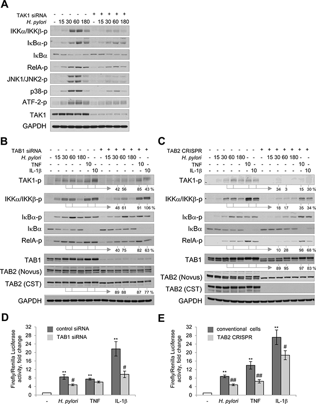 TAK1/TABs complex is required for NF-&#x03BA;B activation in H. pylori- and IL-1&#x03B2;-stimulated cells.