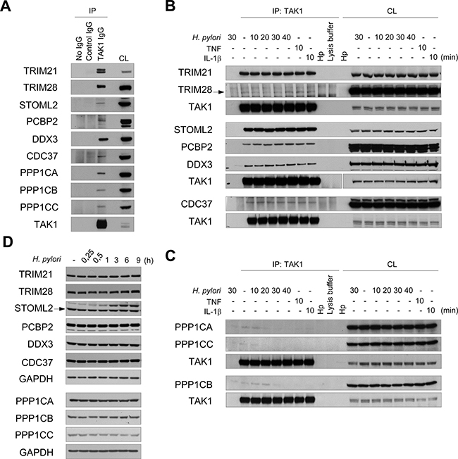 Validation of MS data: TRIM21, TRIM28, STOML2, PCBP2, CDC37, DDX3X and PPP1C interact with TAK1.