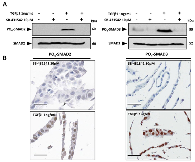 Validation of PO4-SMAD2 (Ser 465/467) and PO4-SMAD3 (Ser 433/435) antibodies for immunohistochemistry.