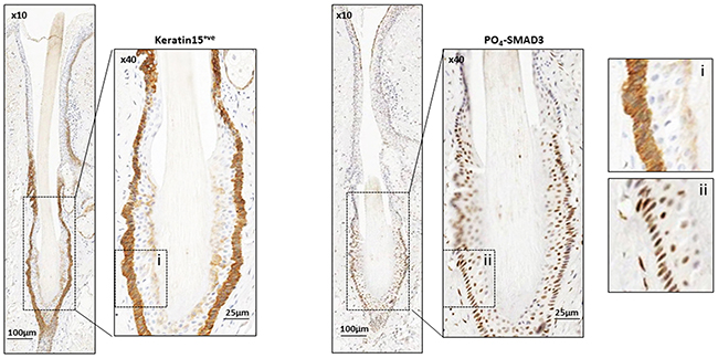 Endogenous TGF-&beta; signalling in Keratin 15 positive hair follicle bulge stem cells.