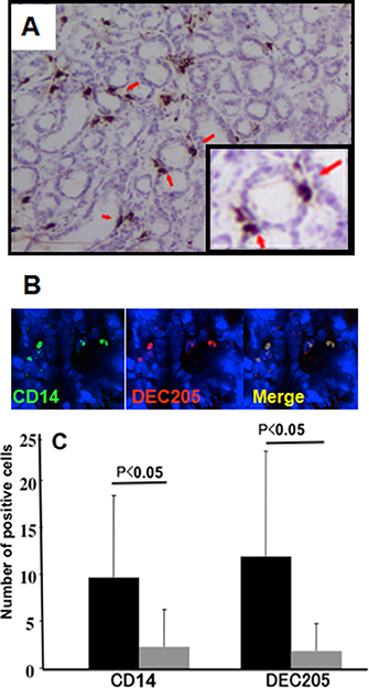 Expression of DEC-205 on macrophages in human gastric mucosa.