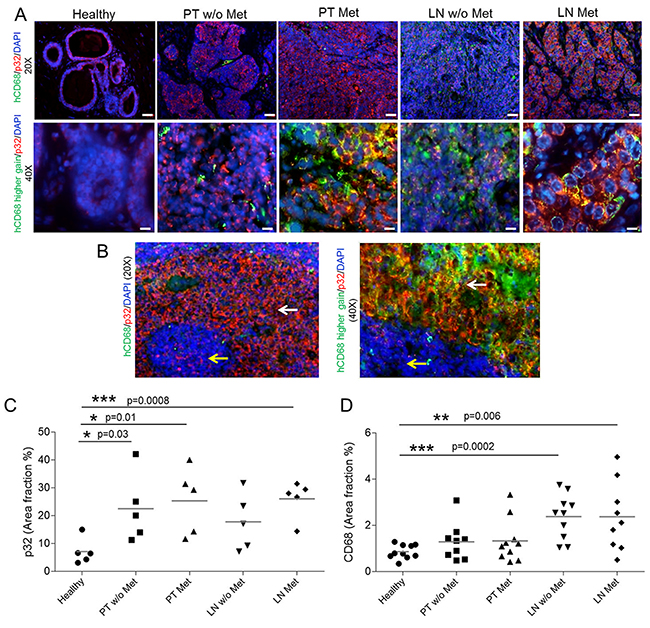 p32 and CD68 expression in human tissue samples.