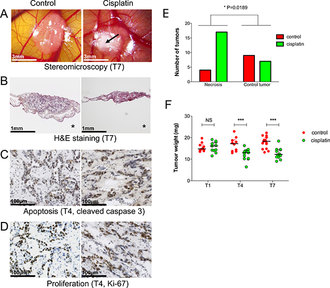 Cisplatin effects on experimental hepatoblastoma on the CAM.