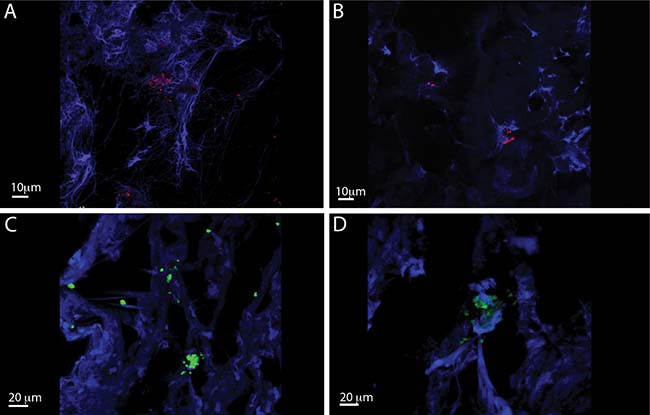 IL-26 expression is Staphylococcus aureus infected chronic venous wounds.