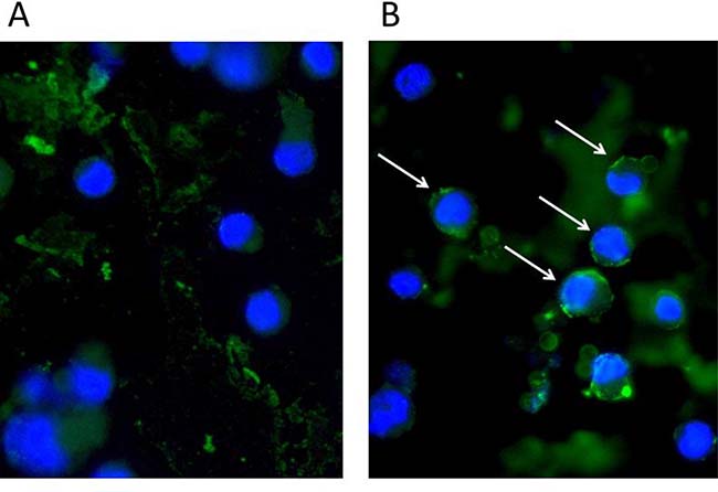Staphylococcal enterotoxin (SEA) triggers IL-26 expression in responsive primary skin T cells.