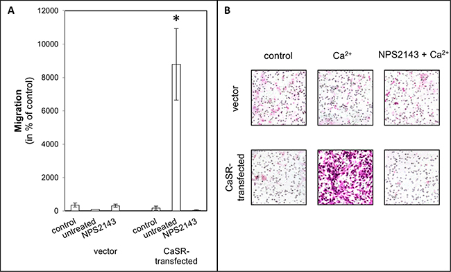 Chemotactical cell migration of CaSR-transfected 786-O cells using calcium as chemotaxin.