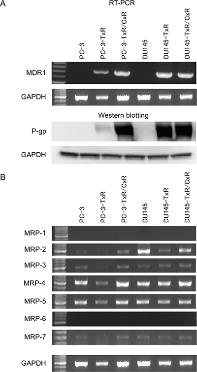 Expression of various drug resistance-related genes in parent, docetaxel-resistant, and cabazitaxel-resistant cells.
