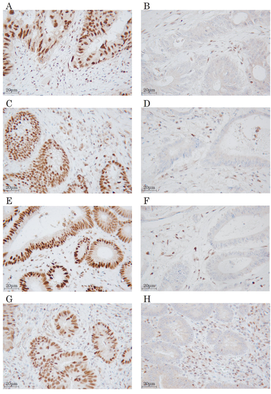 Immunohistochemical staining for mismatch repair proteins.
