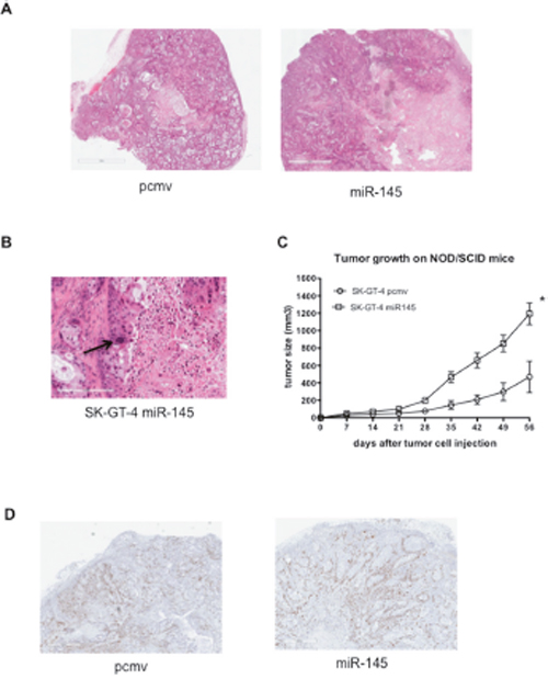 miR-145 expression in EAC cells leads to bigger tumors.