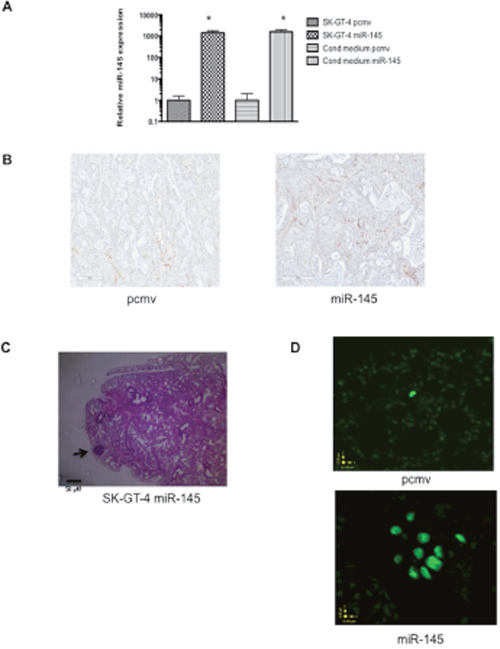 miR-145 expression in EAC increases metastasis but not angiogenesis in xenograft model.