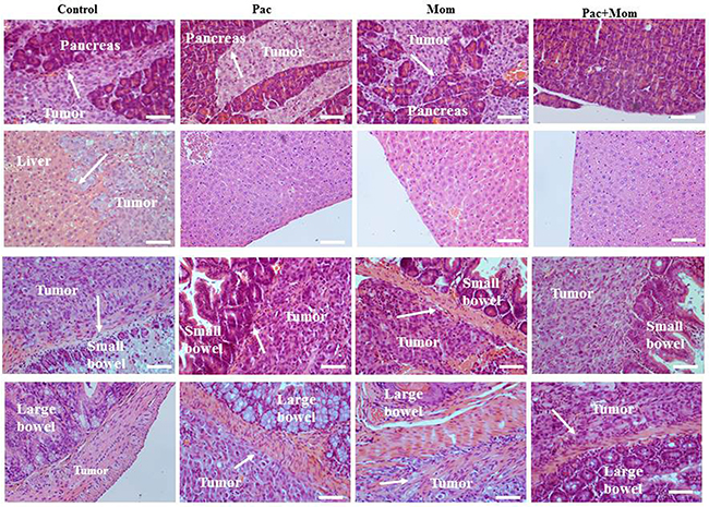 Histological assessment of pancreatic, hepatic, small and large bowel infiltration by tumors developed in mice inoculated with HEY cells in Phase 1.