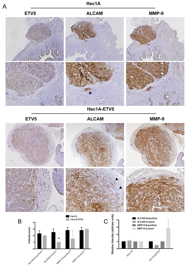 ALCAM is decreased at the invasive front of primary tumors of a controlled model of EEC dissemination.