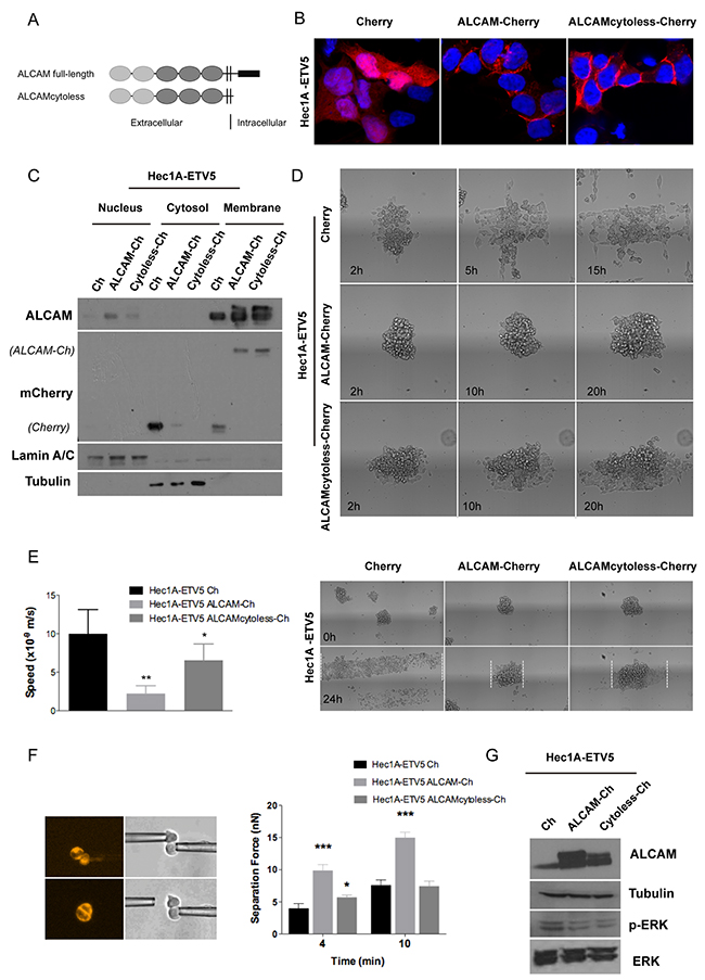 ALCAM overexpression in mesenchymal Hec1A-ETV5 cells decreased cell migration and enhanced cell-cell adhesion.