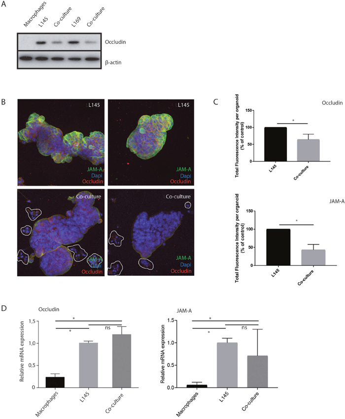 M2 macrophages induce loss of tight junction proteins at tumor cell-cell contacts.