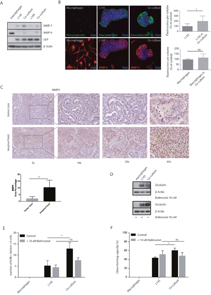 MMP inhibition prevents loss of tight junction protein expression and tumor cell budding.