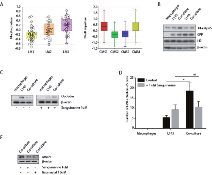 A potential role for NF&kappa;B in macrophage-induced tumor cell budding.