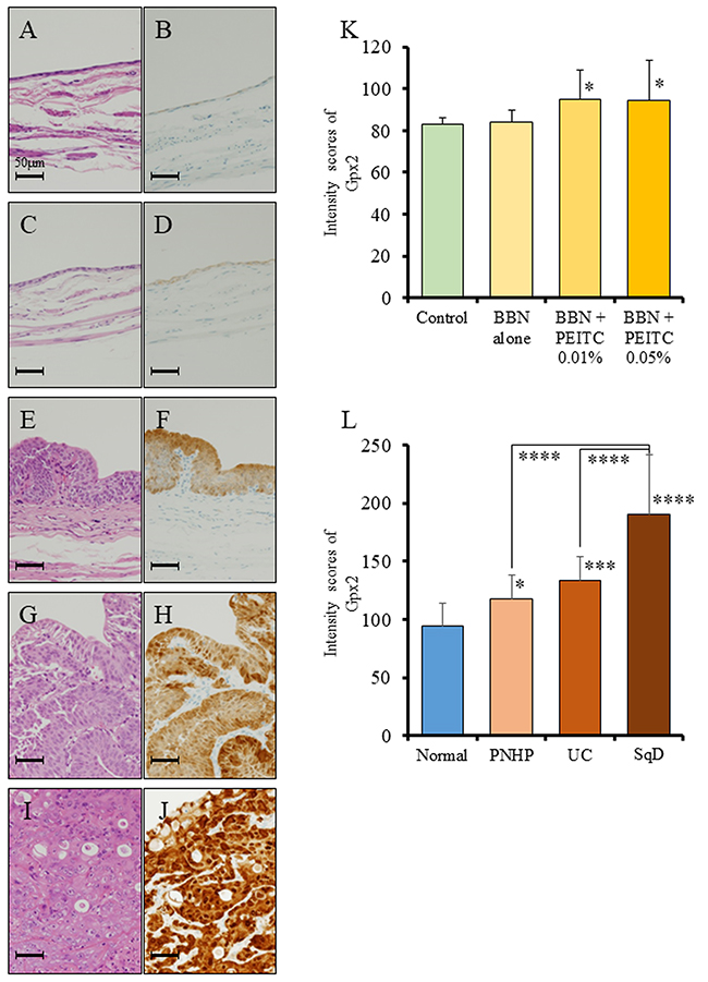 Analysis of Gpx2 expression by immunohistochemistry using a rat bladder carcinogenesis model.