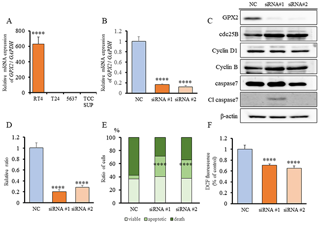 Expression of GPX2 in human bladder cancer cell lines, and GPX2 siRNA transfection in RT4 cells.