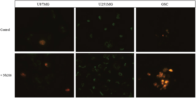 Apoptosis/necrosis test on glioblastoma cell lines U87MG and U251MG and glioblastoma stem cells.