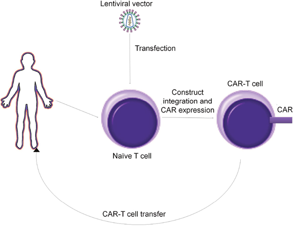 Production alghoritm of CAR T cells.