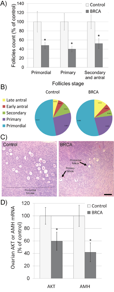 Characteristics of ovaries excised from female BRCA carriers.