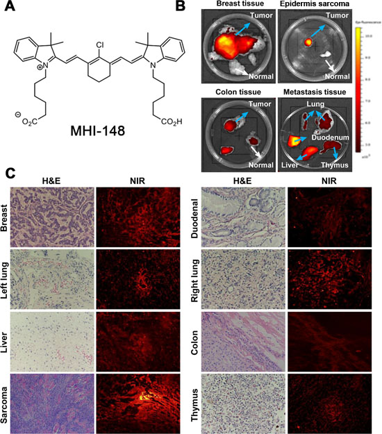 Preferential uptake and retention of MHI-148 dye in canine tumors.