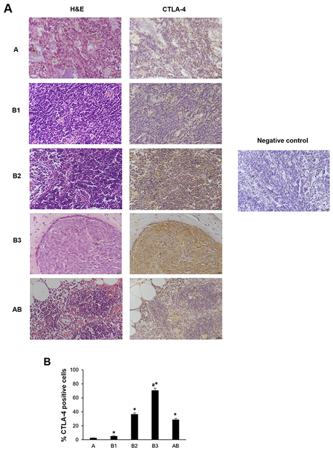 CTLA-4 protein expression in different subtypes of thymoma tissues.