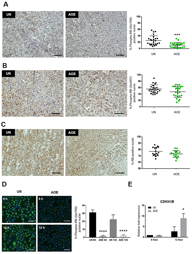 Quantification of RB activation and P27 expression in AOE-reprogrammed tumours and cancer cells.