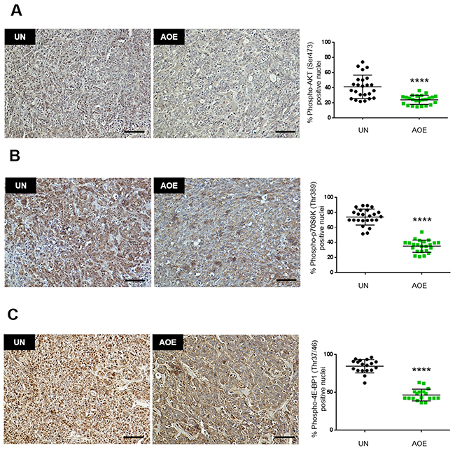 Quantification of AKT, p70S6K and 4E-BP1 activation in AOE-reprogrammed tumours.