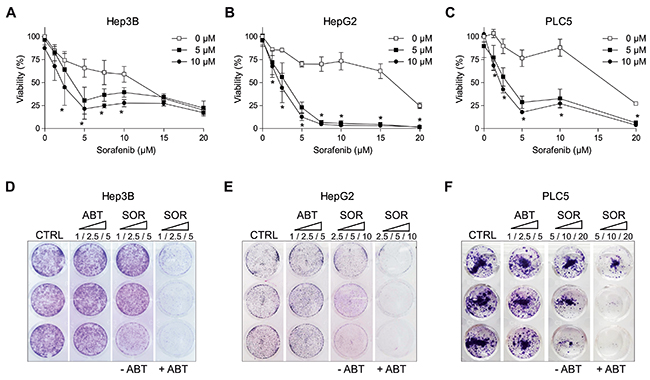 ABT-263 potentiated sorafenib cytotoxicity against different hepatoma cell lines.