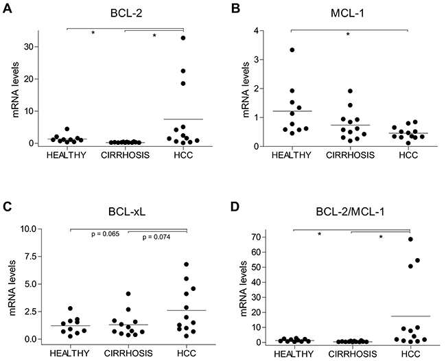 Alterations in BCL-2, MCL-1 and BCL-xL mRNA levels in HCC patients.