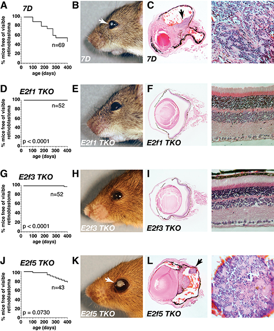 E2f1 and E2f3 inhibit tumorigenesis on a retinoblastoma-sensitized background.