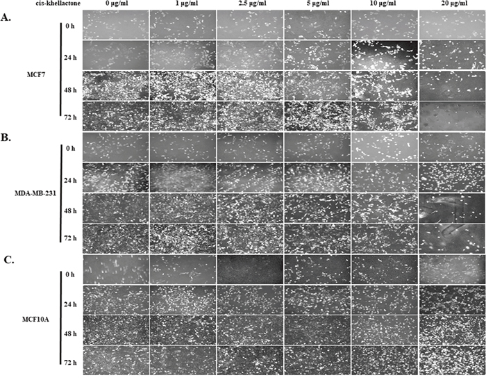 Microscopic morphology of MCF7, MDA-MB-231, and MCF10A cells at various times after treatment with indicated concentrations of cis-khellactone.