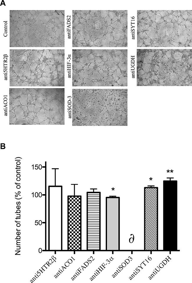 Formation of &#x201C;tubule-like&#x201D; structures of endothelial cells on Matrigel.