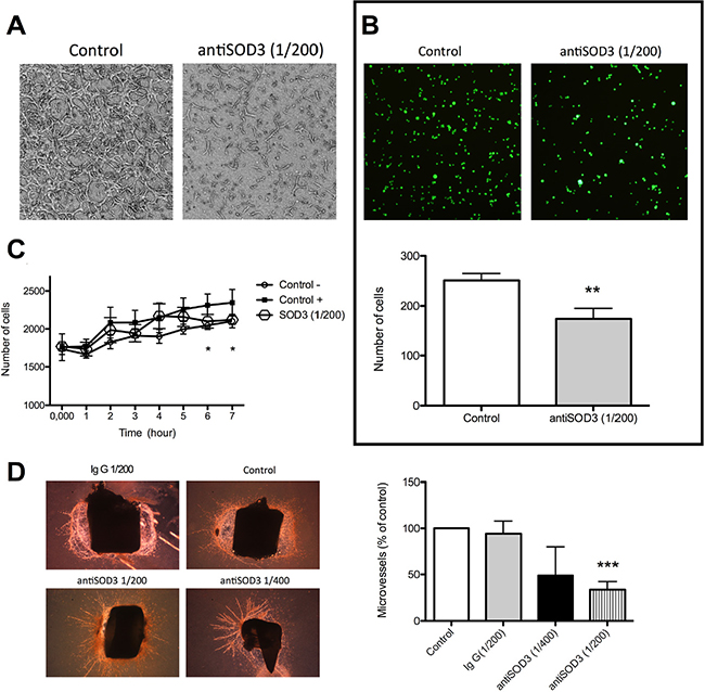 Blocking of SOD3 with antiSOD3 inhibits in vitro and ex vivo angiogenesis.