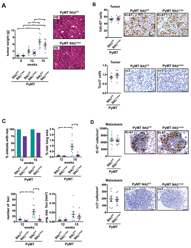 Deletion of Ikk&#x03B2; in myeloid cells does not affect primary tumor growth but suppresses lung metastasis in the PyMT breast cancer model.