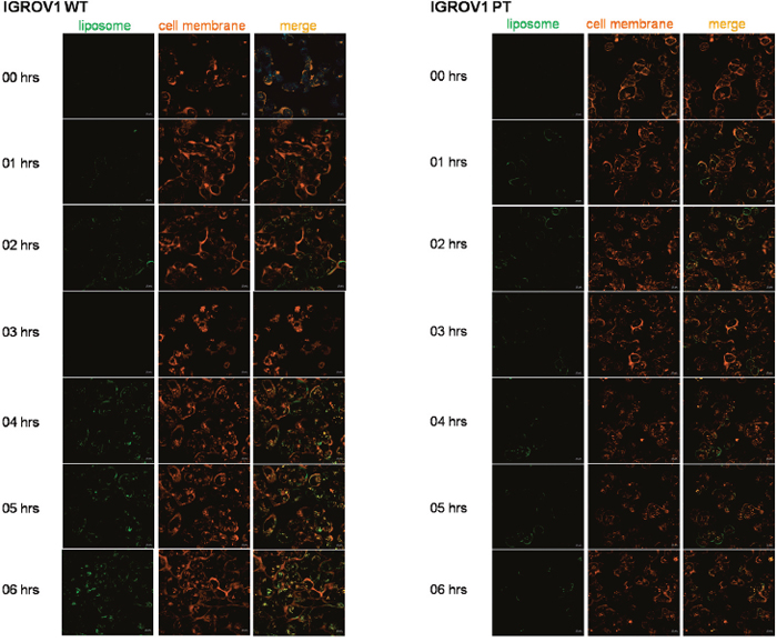 Figura 6: Time-lapse/live confocal laser scanning microscope images of IGROV1 WT and IGROV1 PT incubated with cisplatin/SSL4.