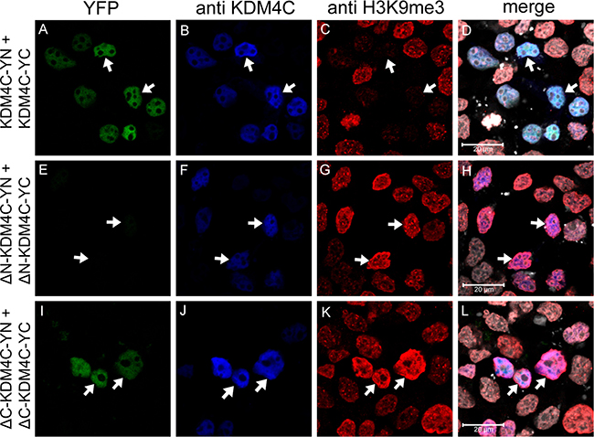 IF microscopy assessing the dimerization of KDM4C YN and YC monomers with deletion mutations.