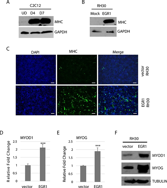 EGR1 promotes differentiation in RMS cells.