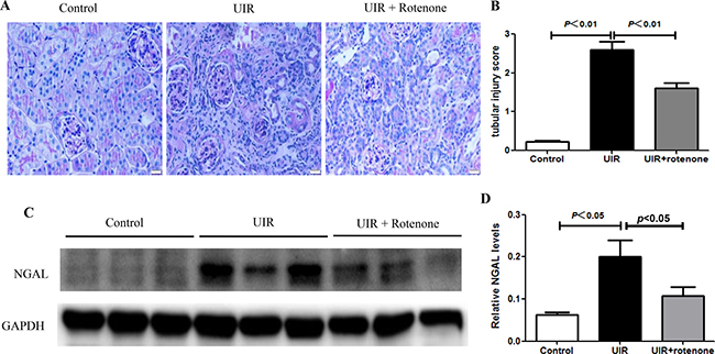 Rotenone treatment improved renal tubular injury in unilateral I/R mice.