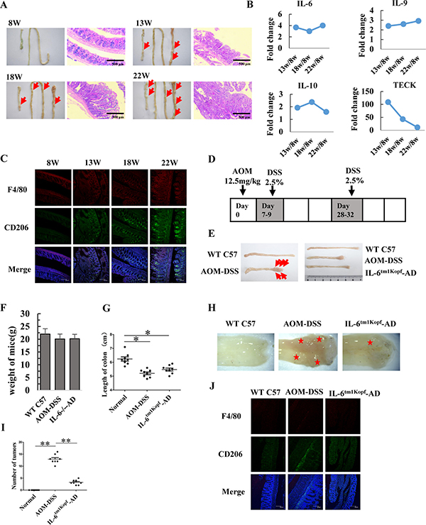 IL-6 contributes to tumorigenesis of colorectal cancer in APCMin/+ and AOM-DSS mice.
