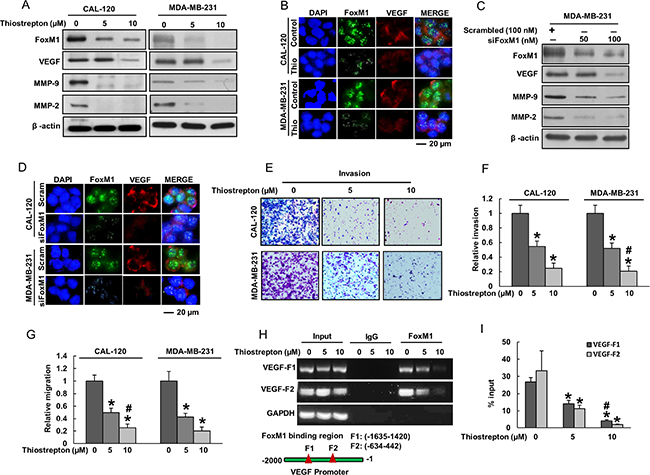 Inhibition of FoxM1 in BC cells decreased invasion, migration and angiogenesis.