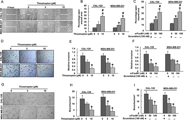 Inhibition of FoxM1 in BC cells decreased HUVECs chemotactic migration, invasion, and tube formation.