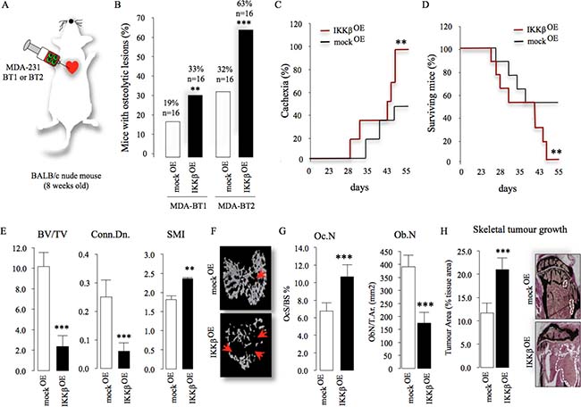 Cancer-specific IKK&#x03B2; exacerbates bone metastasis and enhances skeletal tumour growth.