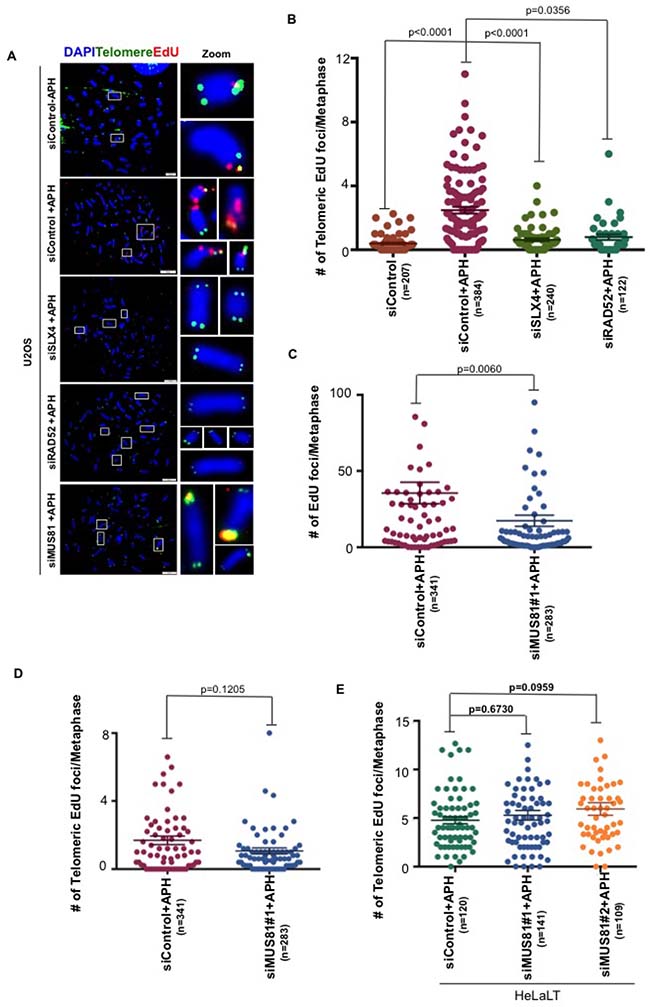 Telomeric MiDAS is also SLX4- and RAD52-dependent, but independent of MUS81.