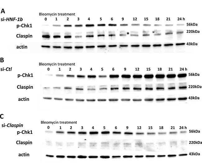 Effect of HNF-1&#x03B2; or Claspin on the expression of p-Chk1 and Claspin protein.