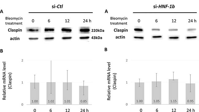 Effect of HNF-1&#x03B2; on Claspin protein and mRNA levels.