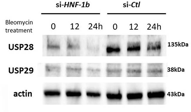 Effect of HNF-1&#x03B2; on the USP28 and USP29 protein expression after bleomycin.